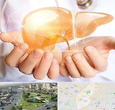 دکتر سرطان کبد در کمال شهر کرج 
