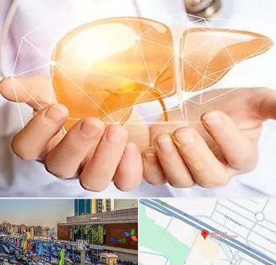 دکتر سرطان کبد در لاله پارک تبریز