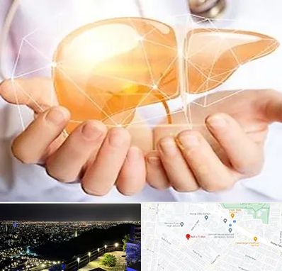 دکتر سرطان کبد در هفت تیر مشهد 