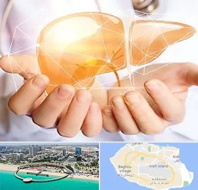 دکتر سرطان کبد در کیش