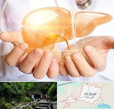 دکتر سرطان کبد در علی آباد کتول