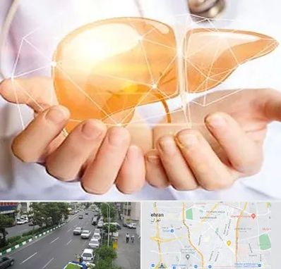 دکتر سرطان کبد در ستارخان 