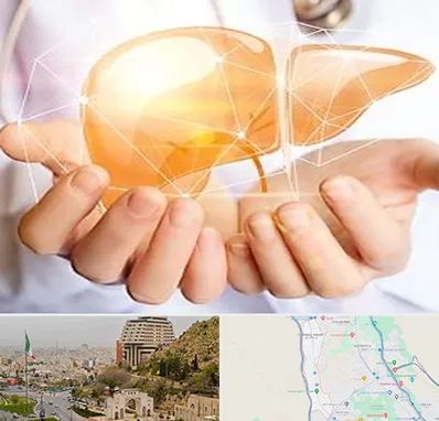 دکتر سرطان کبد در فرهنگ شهر شیراز 