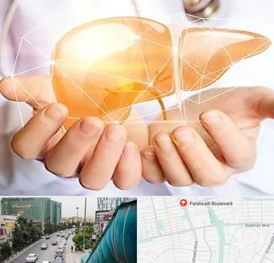 دکتر سرطان کبد در بلوار فرحزادی