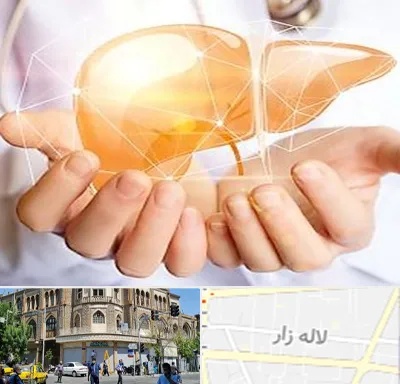 دکتر سرطان کبد در لاله زار