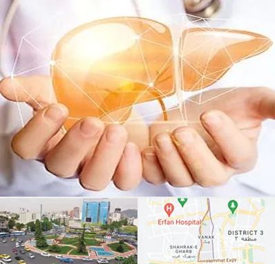 دکتر سرطان کبد در ونک 