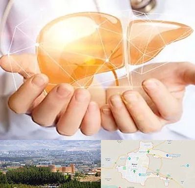 دکتر سرطان کبد در بیرجند