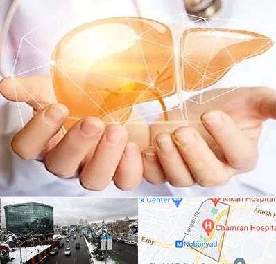 دکتر سرطان کبد در اقدسیه 