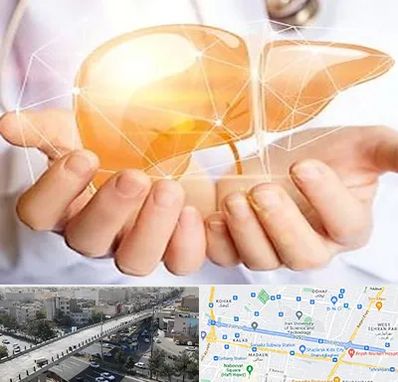 دکتر سرطان کبد در فرجام 