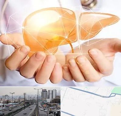 دکتر سرطان کبد در بلوار ارتش