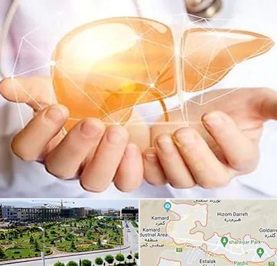 دکتر سرطان کبد در پردیس