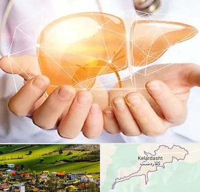 دکتر سرطان کبد در کلاردشت