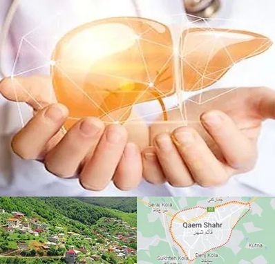 دکتر سرطان کبد در قائم شهر