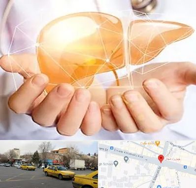 دکتر سرطان کبد در شهناز تبریز