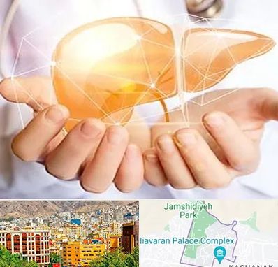 دکتر سرطان کبد در نیاوران 