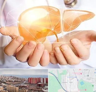 دکتر سرطان کبد در سهند تبریز