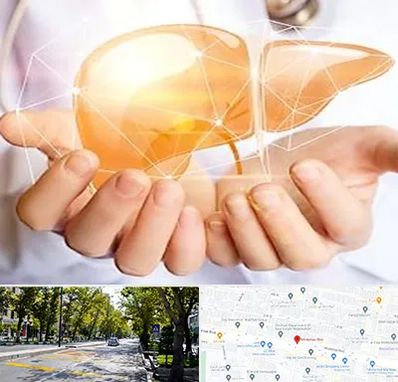 دکتر سرطان کبد در میرداماد 