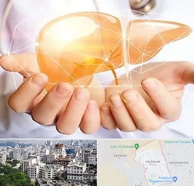 دکتر سرطان کبد در ولنجک 