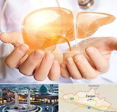 دکتر سرطان کبد در زنجان