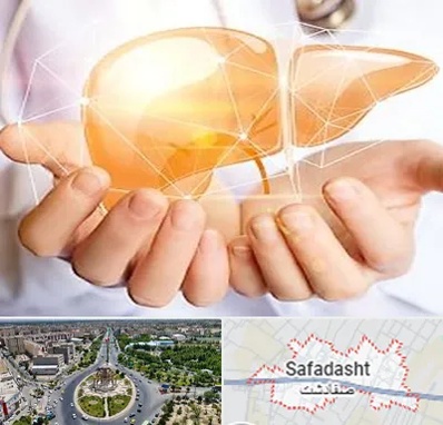 دکتر سرطان کبد در صفادشت