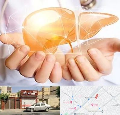 دکتر سرطان کبد در باجک قم