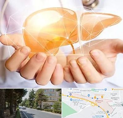 دکتر سرطان کبد در مهرویلا کرج 