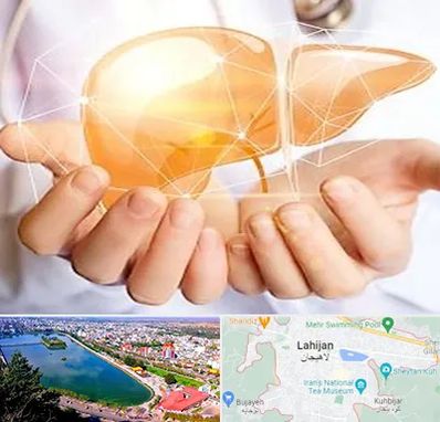 دکتر سرطان کبد در لاهیجان