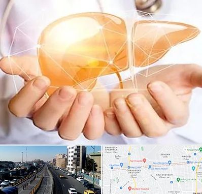 دکتر سرطان کبد در پیروزی 