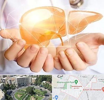 دکتر سرطان کبد در جهانشهر کرج 