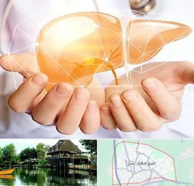 دکتر سرطان کبد در صومعه سرا