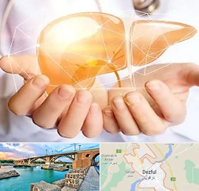 دکتر سرطان کبد در دزفول