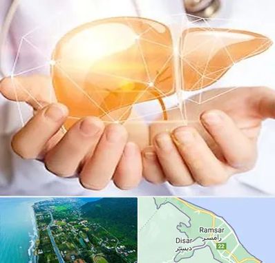 دکتر سرطان کبد در رامسر