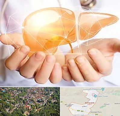دکتر سرطان کبد در دماوند