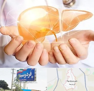 دکتر سرطان کبد در فردوسیه شهریار
