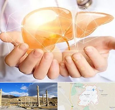 دکتر سرطان کبد در مرودشت