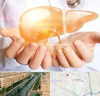 دکتر سرطان کبد در فاز سه اندیشه
