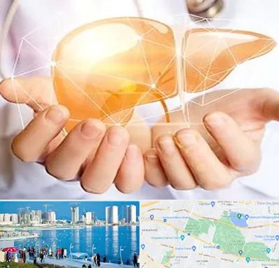 دکتر سرطان کبد در چیتگر 