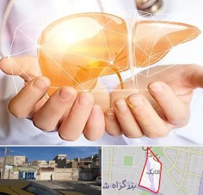 دکتر سرطان کبد در اتابک