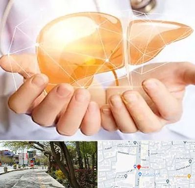 دکتر سرطان کبد در خیابان توحید اصفهان 
