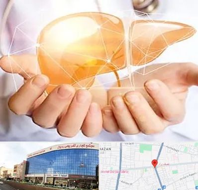 دکتر سرطان کبد در نصف راه تبریز