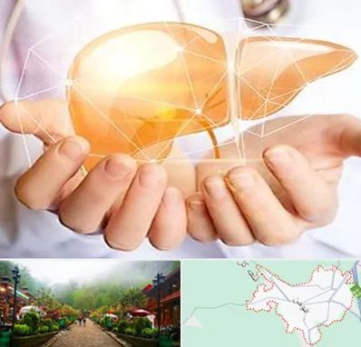 دکتر سرطان کبد در فومن