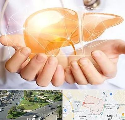 دکتر سرطان کبد در شاهین ویلا کرج 