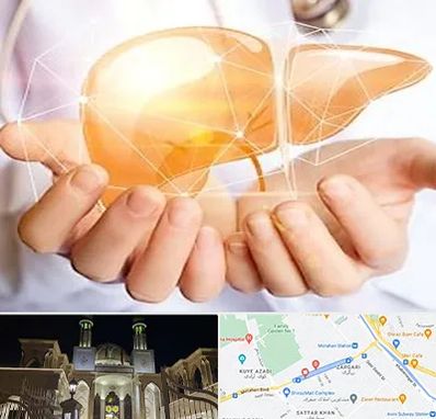 دکتر سرطان کبد در زرگری شیراز 