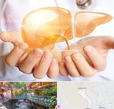 دکتر سرطان کبد در درکه