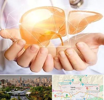 دکتر سرطان کبد در منطقه 1 تهران 