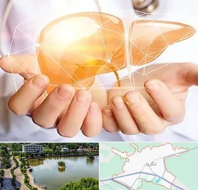 دکتر سرطان کبد در لنگرود