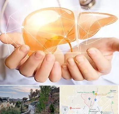 دکتر سرطان کبد در باغستان کرج 