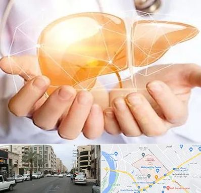 دکتر سرطان کبد در زیتون کارمندی اهواز 