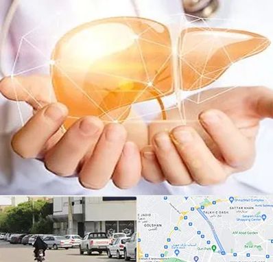 دکتر سرطان کبد در قدوسی شرقی شیراز 