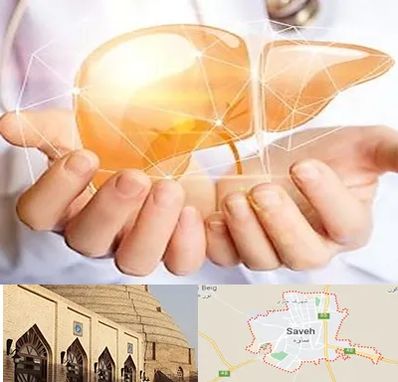 دکتر سرطان کبد در ساوه